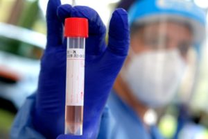 Biancavilla, nuovo caso di Covid: è un 80enne sintomatico, ricoverato al 'San Marco' di Catania