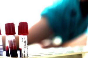 Coronavirus, in Sicilia impennata di contagi: 179 i nuovi positivi di oggi