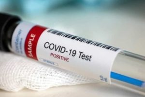 Coronavirus, in Sicilia 102 nuovi casi: 62 i contagiati a Palermo, 12 a Catania
