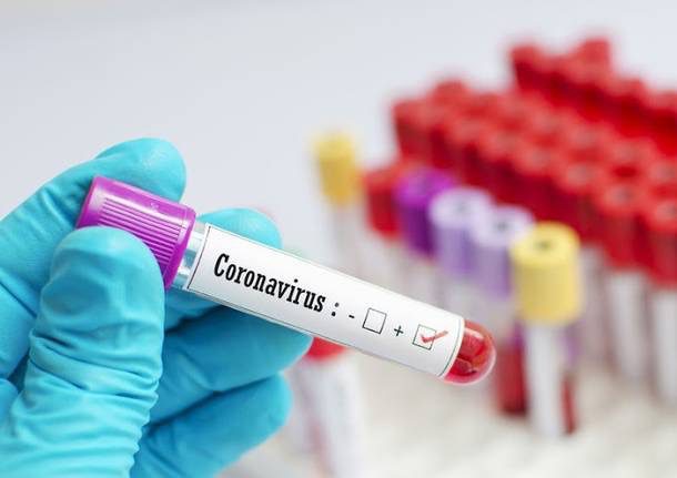 Coronavirus, in Sicilia positivi ancora in aumento: 259 e 3 morti in 24 ore. A Palermo 131 nuovi contagiati
