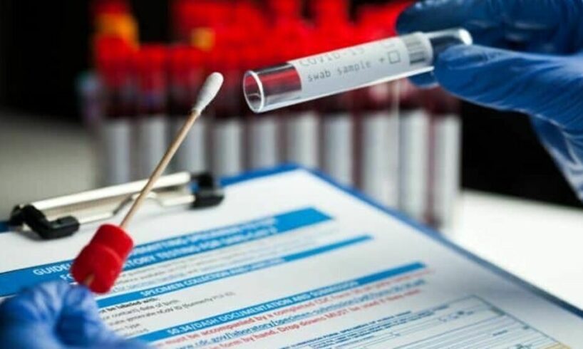 Belpasso, è una donna la 27esima vittima del covid. Per Bronte si valuta di nuovo la ‘zona rossa’