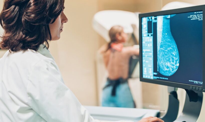 Biancavilla, domani screening mammografico gratuito presso la ‘Radiologia”: iniziativa dell’Apca di Adrano