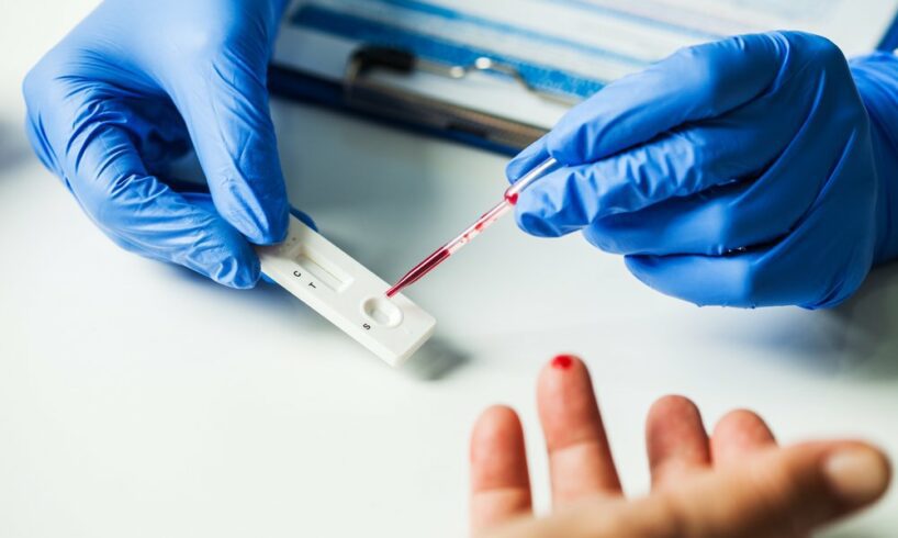 Covid, in Sicilia Ugl Salute chiede test sierologico per il personale sanitario pubblico e privato