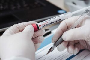 Covid, Asp Catania fa pagare il tampone rapido o molecolare ai non vaccinati: il costo è di 15 e 50 euro