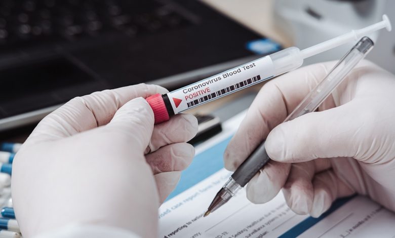 Covid, Asp Catania fa pagare il tampone rapido o molecolare ai non vaccinati: il costo è di 15 e 50 euro