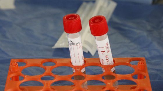 Covid, a Belpasso e Nicolosi positivi in crescita: a Paternò 110 contagiati e 210 in isolamento