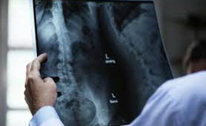 All’Asp di Catania assunti 15 radiologi: 5 per l’ospedale di Biancavilla, 2 per Bronte, 1 per Paternò