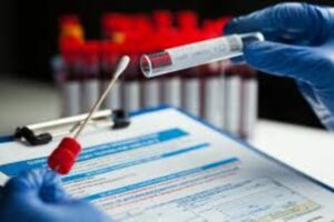Ad Adrano e Paternò due vittime a causa del covid: 261 e 206 i positivi