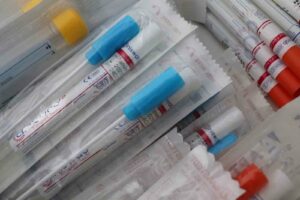 Covid, boom di positivi ad Adrano (493) e Paternò (524): casi in aumento nel resto del comprensorio