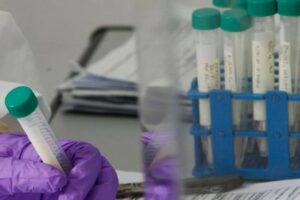 Covid, a Catania 10 ‘rinforzi’ per i medici e tamponi di fine isolamento in ogni distretto sanitario