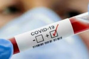 Nuovo record di positivi al covid in Sicilia.