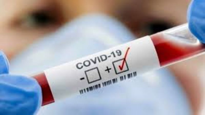 Nuovo record di positivi al covid in Sicilia.