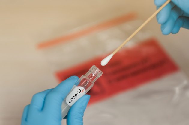 Covid, nel Catanese quasi 20 mila positivi e 344 ricoverati: casi in calo in tutti i comuni