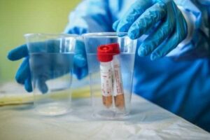 Covid, in discesa la curva dei contagi (-13,3%) ma i decessi sono in aumento: balzo in avanti delle quarte dosi