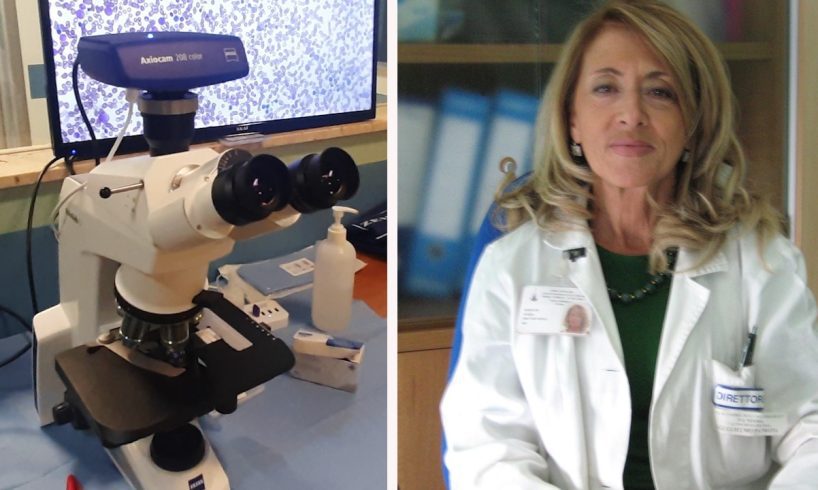 Lions club Acitrezza Verga dona moderno microscopio a reparto onco-ematologia dell’Arnas Garibaldi