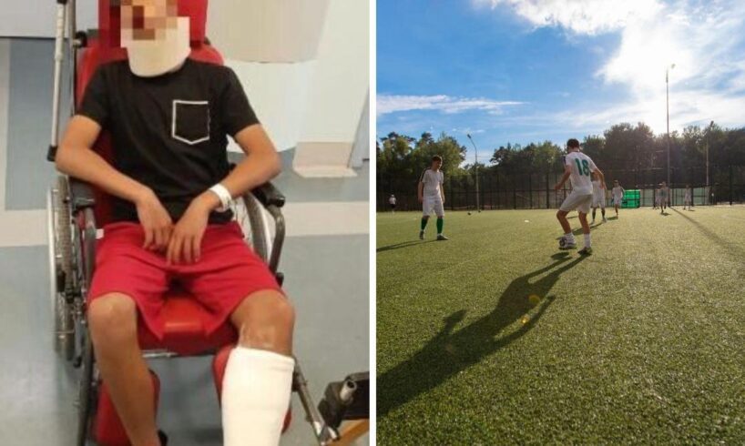 Torino, calci e pugni al torneo Under 14: papà entra in campo e manda all’ospedale un portiere di 13 anni