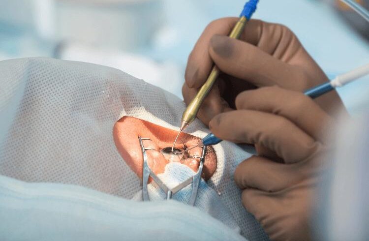 Catania, infezioni dopo interventi di cataratta in una clinica privata: Procura indaga su ricoveri e danni ai pazienti