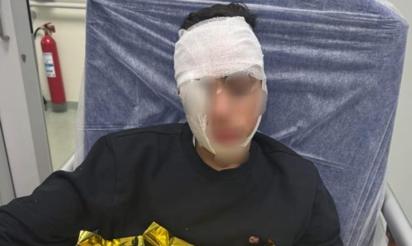 Catania, ragazzo di 14 anni pestato a sangue da una baby gang in Piazza Stesicoro